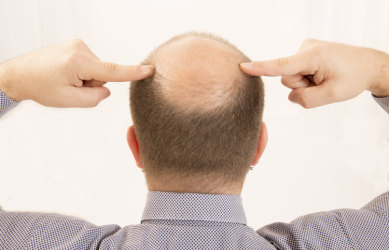 “秃顶”男人更易感染新冠重症！秃顶男人：我招谁惹谁了？